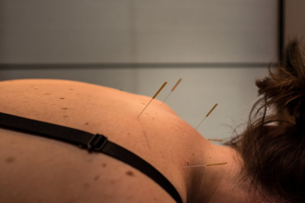 Fysio Utrecht, Fysiotherapie Utrecht, manuele therapie, sportfysiotherapie, Bol.com, nekklachten, rugklachten, fysiotherapie, Medical taping, Dry needling, Fysiotherapeut, Actifytaal, medical taping, Dry needling, online fysiotherapie, Schouderklachten, manuele therapie, sportfysiotherapie, personal training, sportblessures, nekpijn, schouderklachten, hernia, rugpijn, artrose