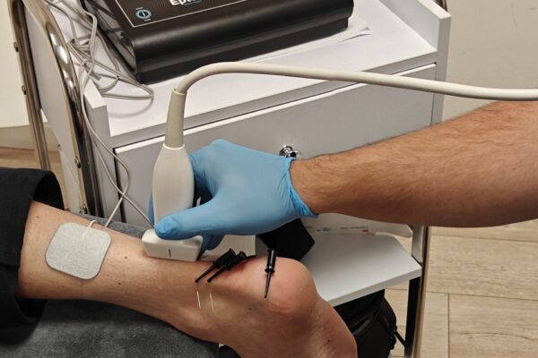 EPTE onder begeleiding van echografie bij de hiel van een patiënt die op de behandelbank ligt