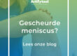 Vrouwelijke fysiotherapeut in blauw t-shirt is bezig om een gescheurde meniscus te behandelen.